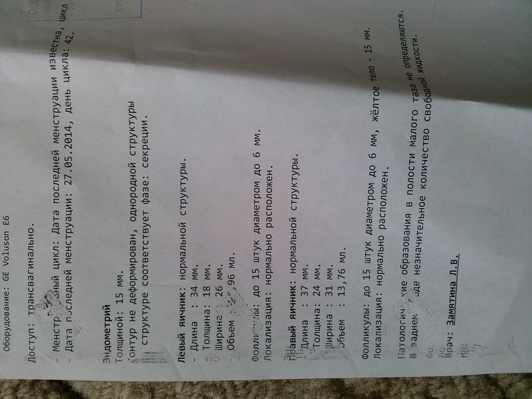 девочки, гляньте узи?