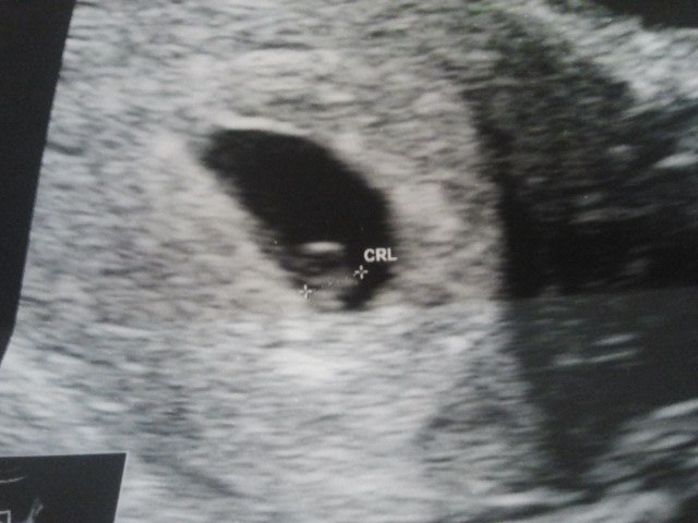 Наконец-то приветственный пост:)