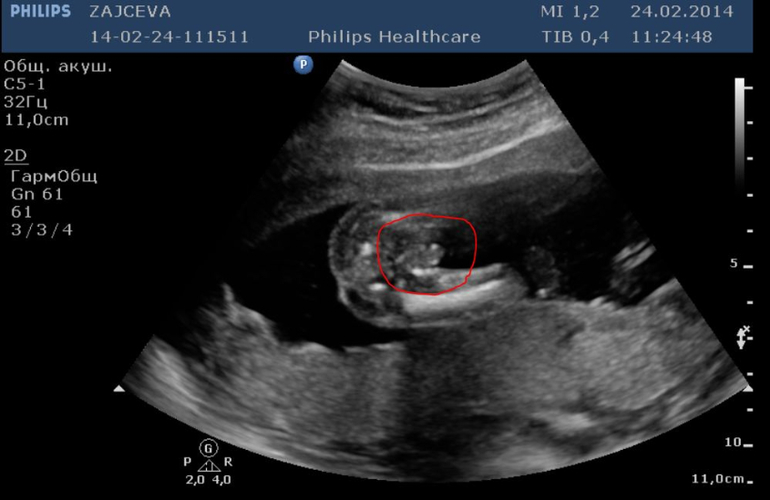 Наконец-то приветственный пост:)