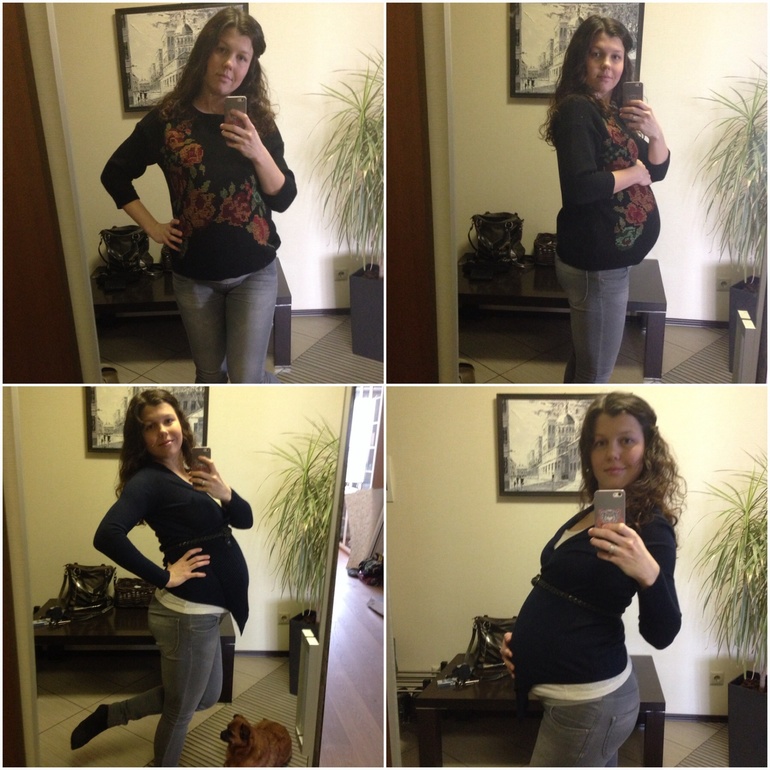 34 недели. УЗИ