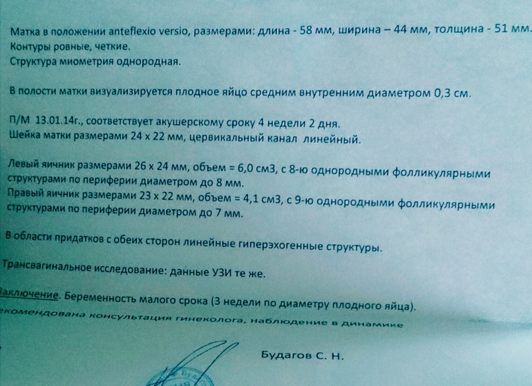 На память)))