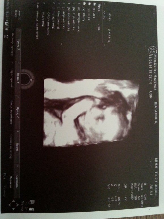 Тайна раскрыта))))))))))