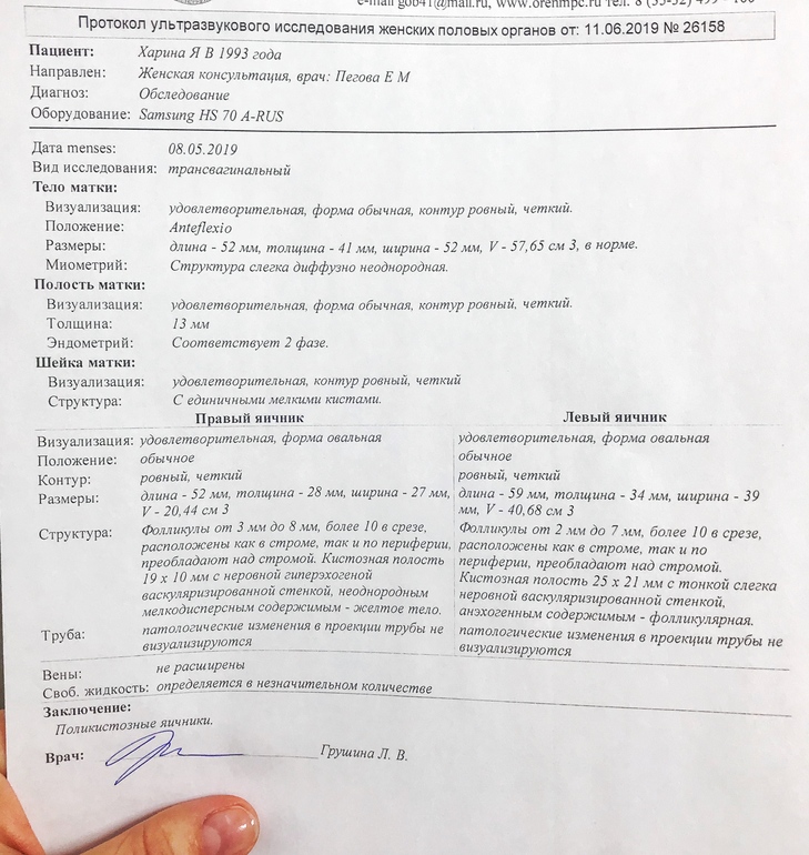 Что значит яичники не визуализируются на узи. Что такое визуализация удовлетворительная на УЗИ. Визуализация удовлетворительная затруднена. Анэмбриония УЗИ заключение.