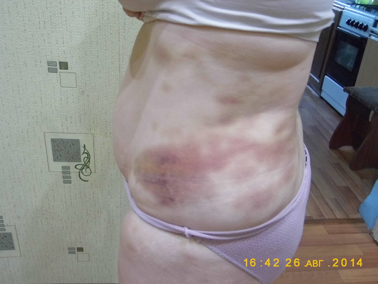 dac7561585adf9c8a2a0599953c67d1f.jpg