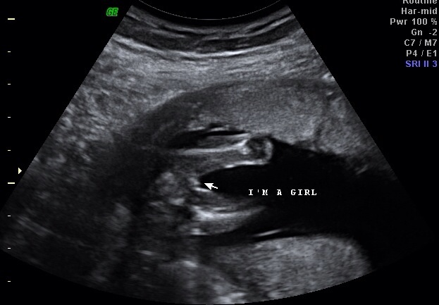 Мамочки мне интересно ваше мнения