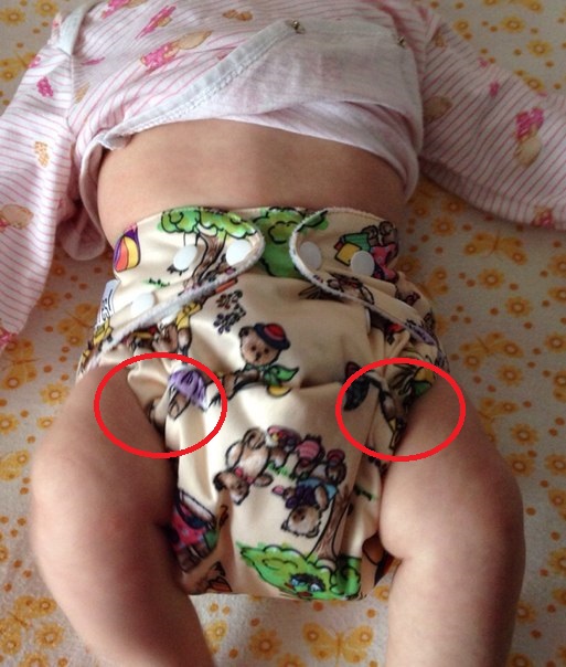 GlorYes протекают.