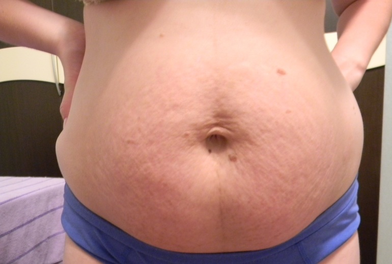 Я и мои растяжки!