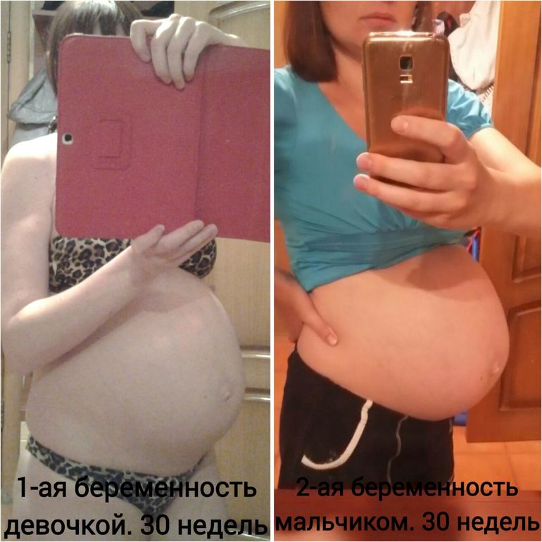 Беременность сильно поправляюсь. 3 Беременность. 31 Неделя огромный живот. Очень поправилась в беременность.
