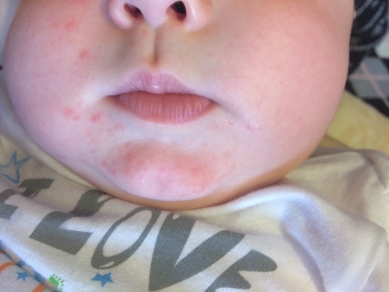 А что означают слюни у 1,5 месячного ребенка? — 9 ответов | форум Babyblog