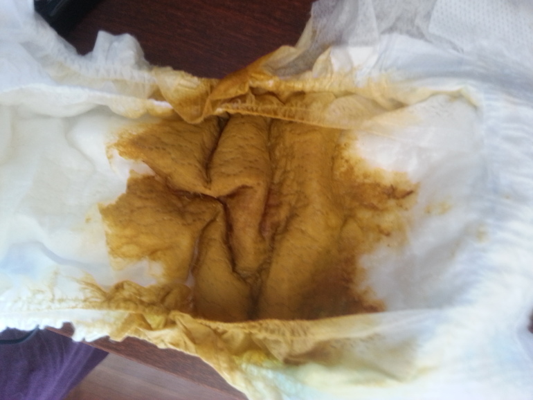 У нас нормальные каки или нет?