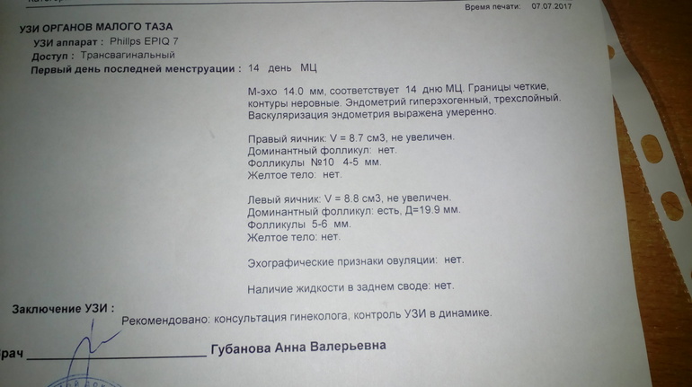 Фолликулометрия спб. Фолликулометрия заключение УЗИ. Тест на овуляцию и фолликулометрия.