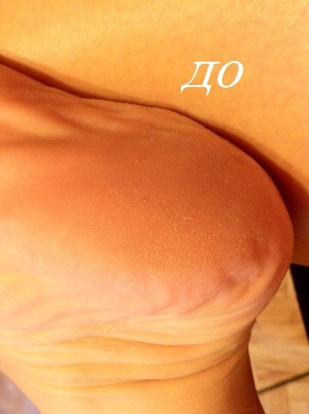 Крем-спасатель от Мери Кей!