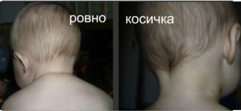 Как по волосам первого ребенка можно определить пол второго ребенка