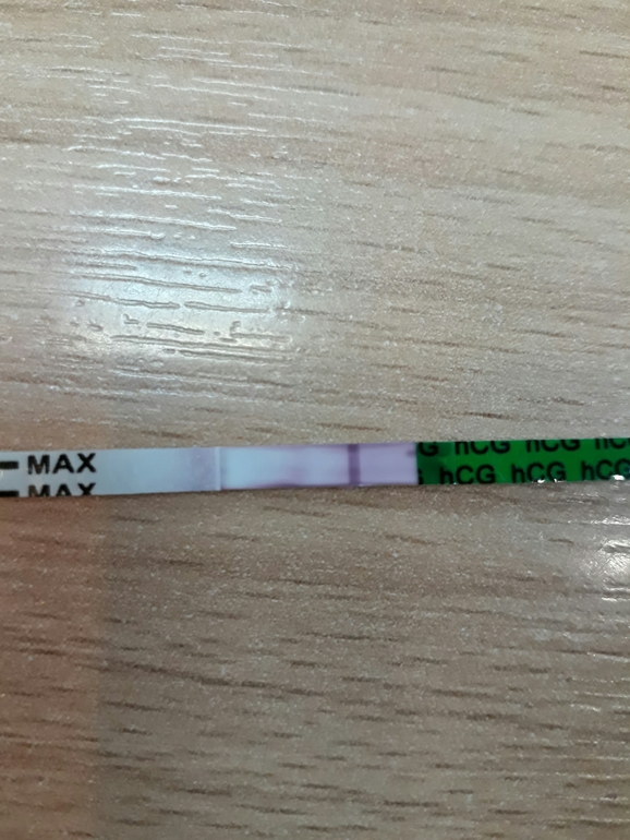 Пронация стопы гиперпронация. Как определить пронацию стопы. Тест на мокрые пеленки в 2 месяца. Мокрый тест. Плоскостопие пронация стопы.