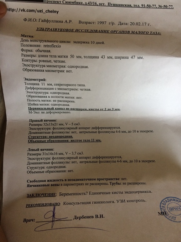 Задержка дней тесты положительные пошли месячные
