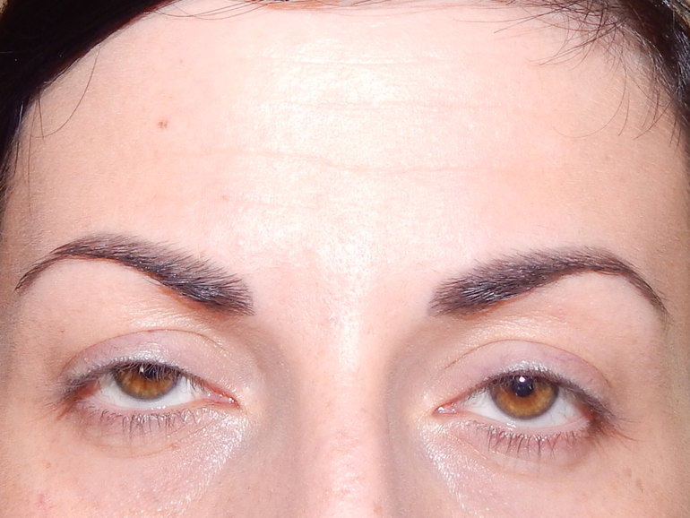 Как можно поменять свою форму глаз и лицо