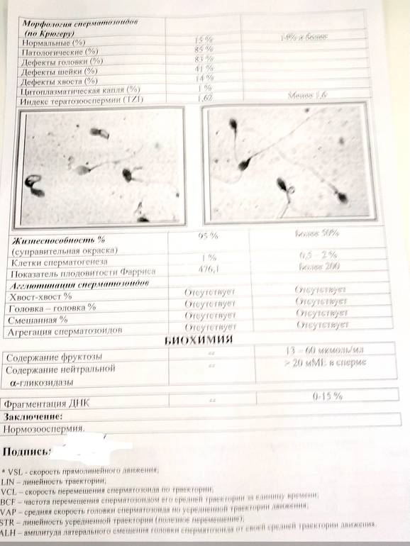 Морфология по Крюгеру (оценка внешнего строения сперматозоидов) - Геном в Томске