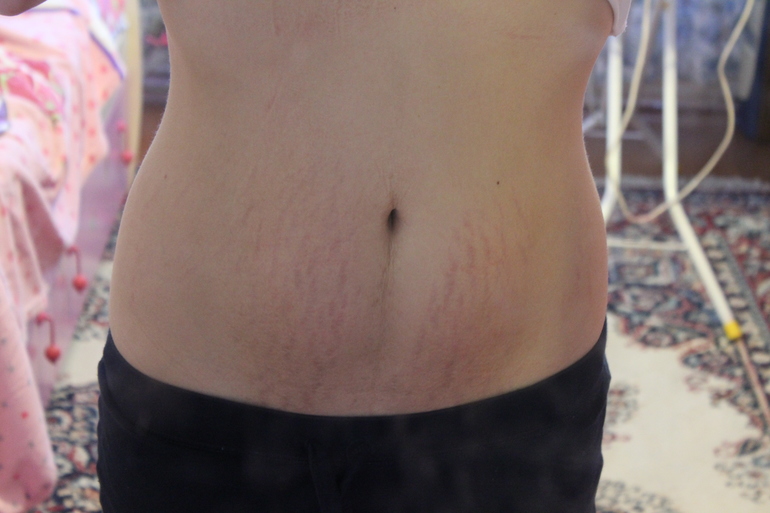 Ребенку месяц!Мы на ГВ.