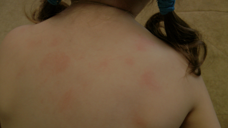 Пятна. нужен совет