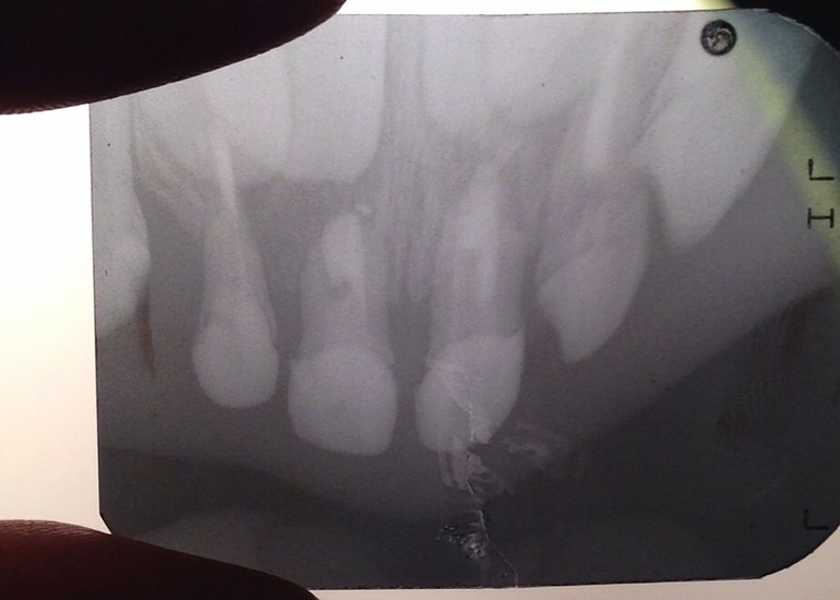 Из Курска рентген