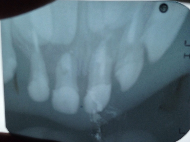 Из Курска рентген