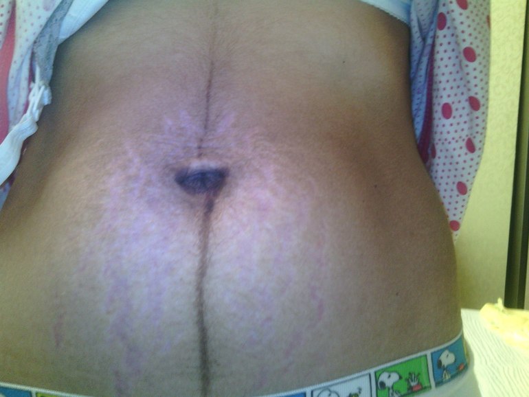 Вот моя прелесть(( Растяжки Часть 2