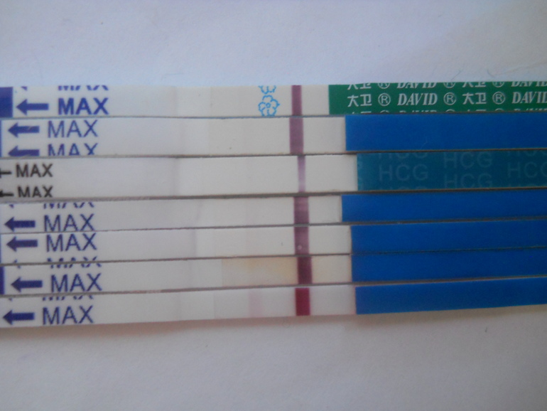 Вот что после вчера стало) Спасибо,девочки)