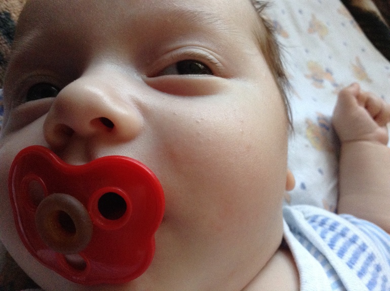 Аллергия или что??