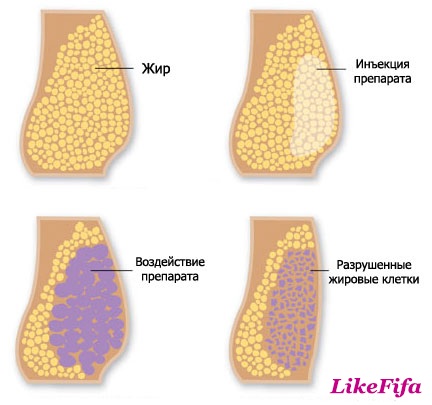 Боремся с целлюлитом