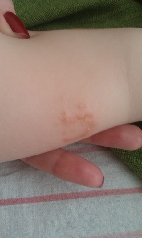 Это ужасное пятно!!!!