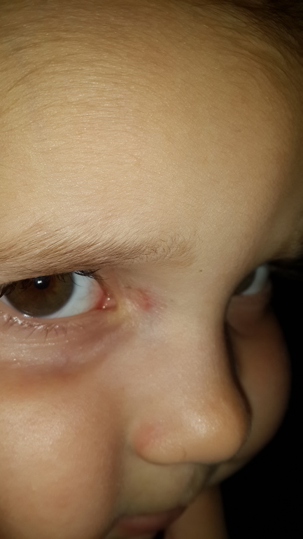 Аллергия это или нет?