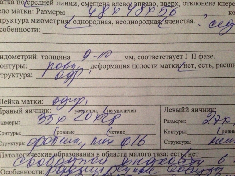 снова я со своими тараканами))