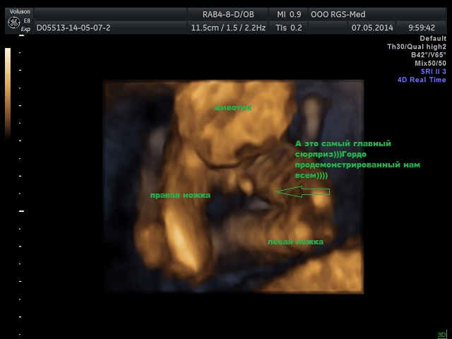 3D УЗИ 19 неделек!!!!!)))))