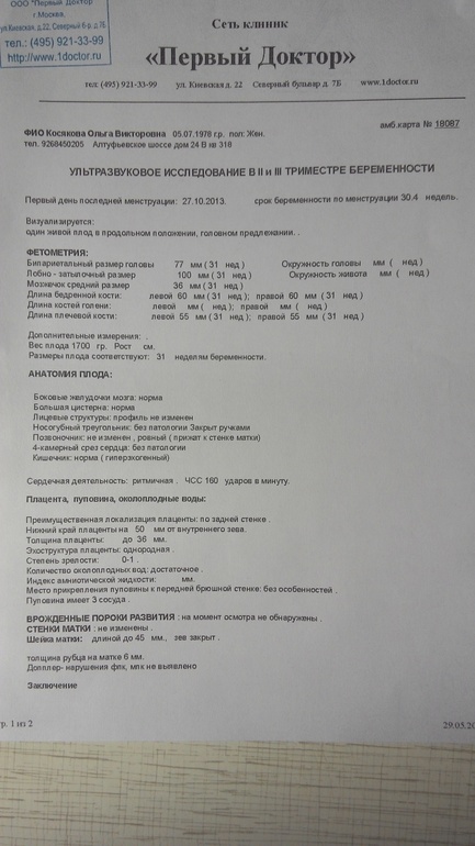 Сходила на узи))