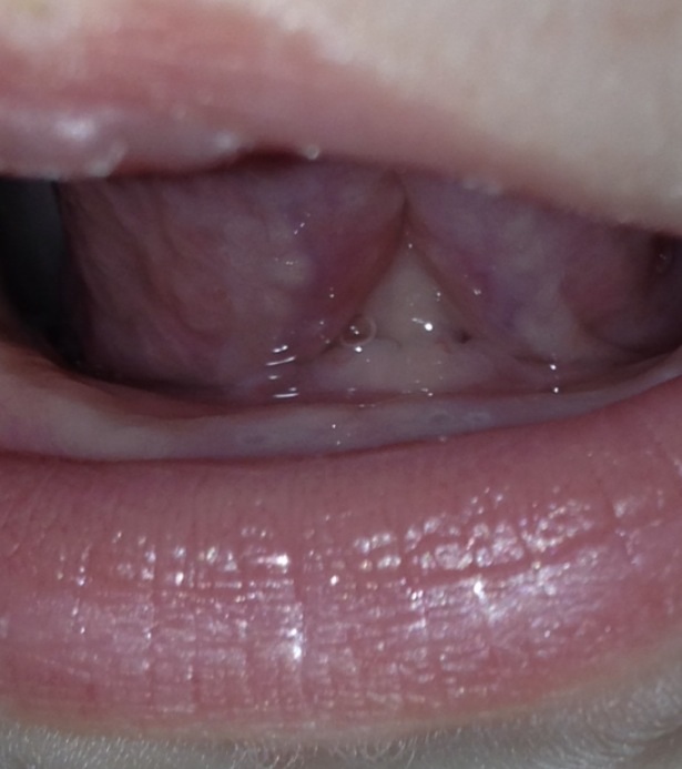 У нас появились точки, но синие!