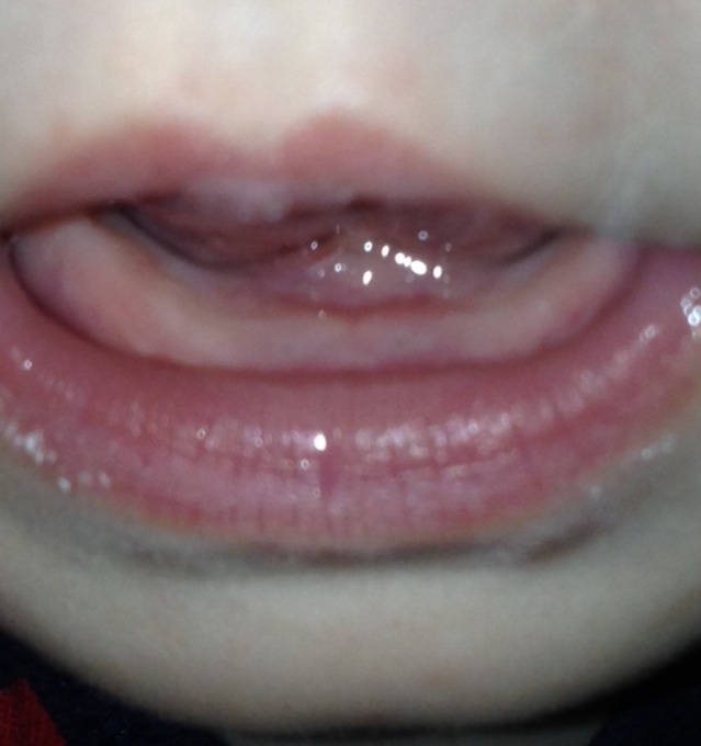 У нас появились точки, но синие!