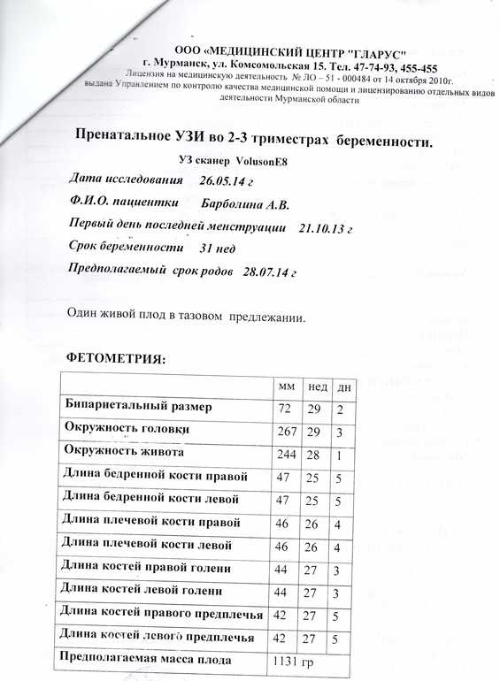 Как страшно жить...