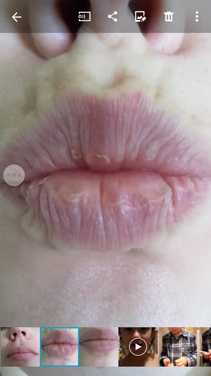 Синие губы у грудничка: почему это бывает и когда надо беспокоиться?