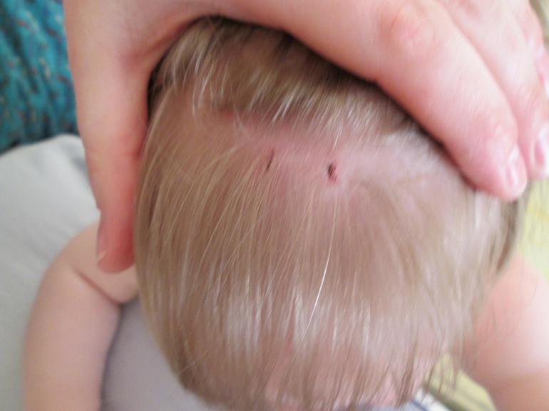 непоседовы беды))