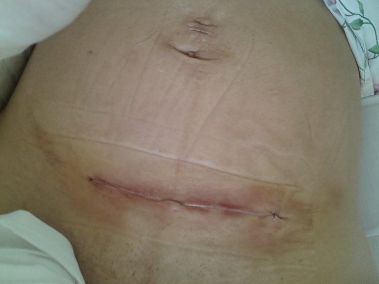 полный отчет. роды. фото.