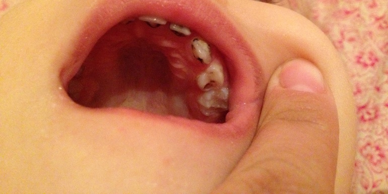 Проконсультируйте пожалуйста!!!