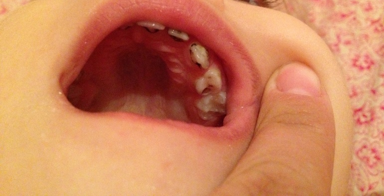 Проконсультируйте пожалуйста!!!