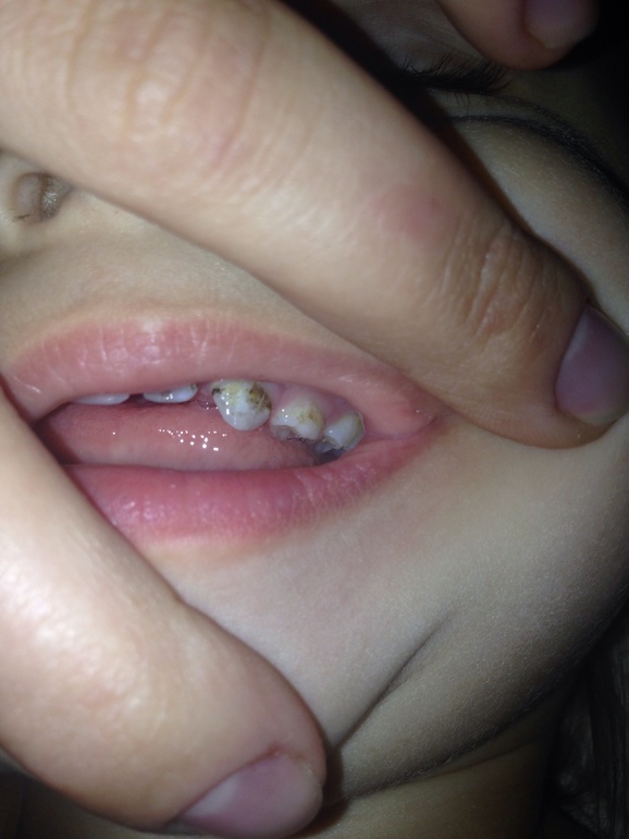 Проконсультируйте пожалуйста!!!