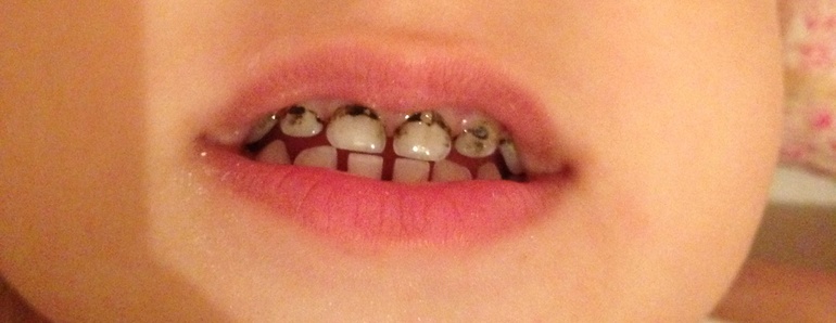 Проконсультируйте пожалуйста!!!