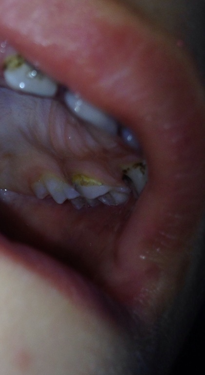 Проконсультируйте пожалуйста!!!