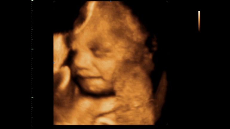 Узи на 31 неделе. Фото УЗИ 31 мая 2023 девочка. 31 Неделя беременности развитие плода вес. Как выглядит ребёнок в 16 недель и пять детей.