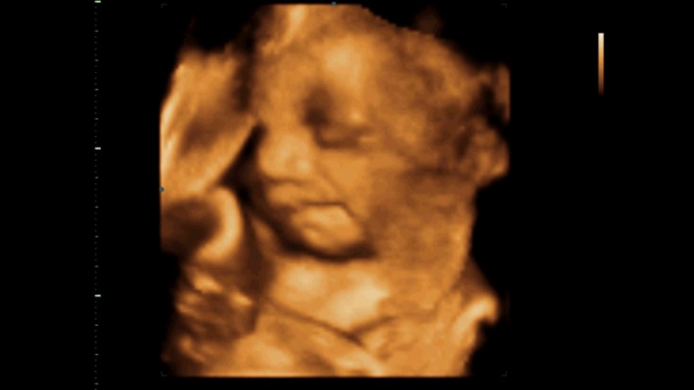 Узи, 31 неделя и 1 день.