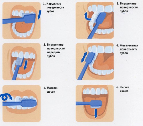 МК-4. Марафон красоты и гармонии. День 9. БЕЛОСНЕЖНАЯ УЛЫБКА или УХОД ЗА ЗУБАМИ