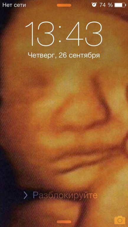 Мои роды ПКС в Китае г. Пекин