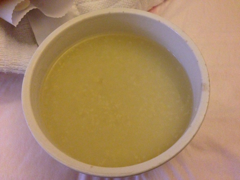 Мои роды ПКС в Китае г. Пекин